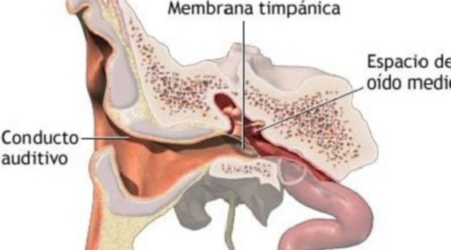 otitis_oido_medio